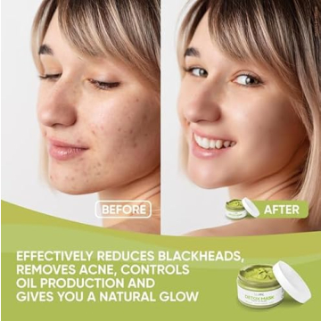 Teami Detox Face Mask for All Skin Types and Hydration