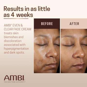Ambi Even & Clear Fade Cream for Even Skin Tone