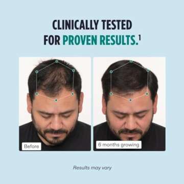 Nutrafol Men's Hair Growth Supplements - 2 Month Supply - Clinically Tested