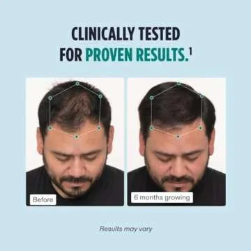 Nutrafol Men's Hair Growth Supplements - 2 Month Supply - Clinically Tested