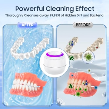 Hiwill Ultrasonic Cleaner for Retainers and Jewelry