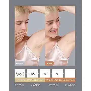 INNZA Laser Hair Removal Device with Sapphire Ice Cooling Function,Upgraded 999999 Flashes IPL Hair Removal Permanent for Women and Men,Depiladora Laser for Facial,Body, Bikini Line,Corded