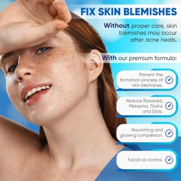 AOBBIY Azelaic Acid 12% Acne Cream for Clear Skin