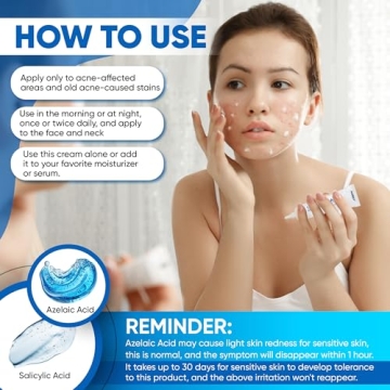 AOBBIY Azelaic Acid 12% Acne Cream for Clear Skin