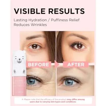 The SAEM Iceland Hydrating Collagen Eye Stick 0.24oz - Anti-wrinkle Moisturizing Eye Balm for Saggy Skin – Under Eye Treatment - Balm to Smooth Skin Texture - Rose Scent