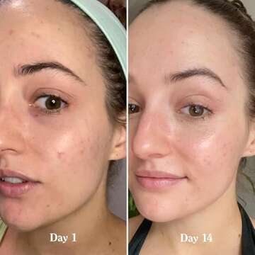 Revitalize Your Skin with Tracie Martyn Toner