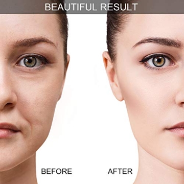 BBTO Silicone Facial Cupping Set for Glowing Skin