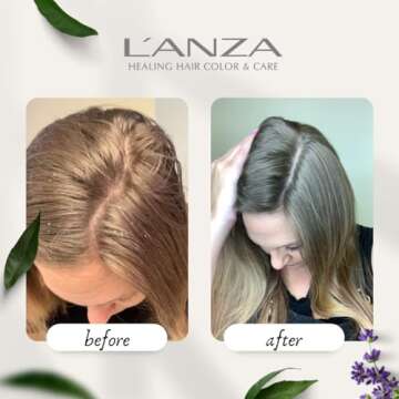 L'ANZA Healing Remedy Scalp Balancing Cleanser, Restores Wellness to Hair and Scalp While Reducing O...