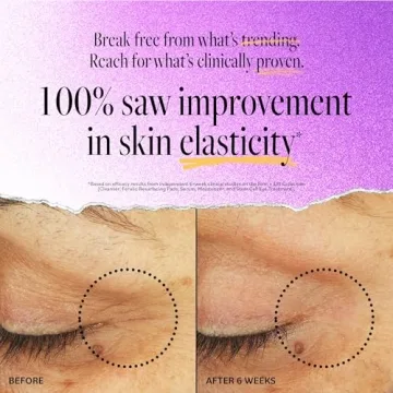 Derma E Stem Cell Lifting Eye Treatment for Youthful Eyes