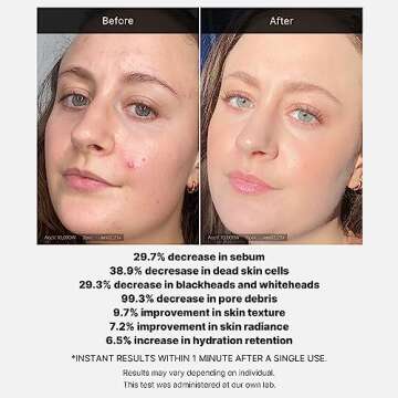 Medicube 21% Acid Wash-off Exfoliant (AHA+BHA+Succinic Acid), Wash-off Resurfacing Serum, Best for bumpy, breakout-prone skin, Korean Skincare (1.41fl.oz.)