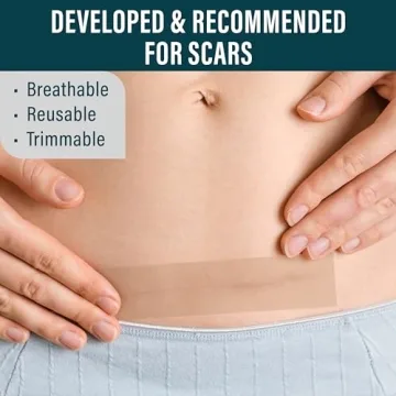NUVADERMIS Silicone Scar Tape - Effective Scar Solution