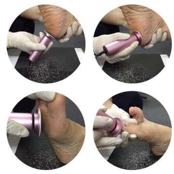 Electric Callus Remover, Ravifun Foot File Grinder Tool with Speed Controller and 60pcs Replacement Sandpaper Disk for Men Women Dead Dry Crack Skin Calluses