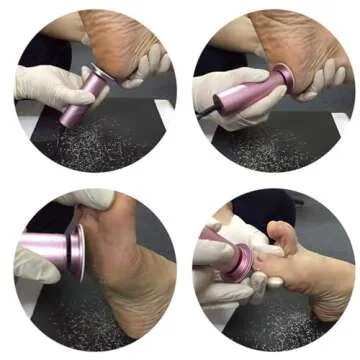 Electric Callus Remover, Ravifun Foot File Grinder Tool with Speed Controller and 60pcs Replacement Sandpaper Disk for Men Women Dead Dry Crack Skin Calluses