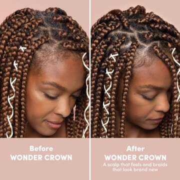 MIZANI Wonder Crown Scalp Cleanser - Helps Stimulate Hair Growth, Removes Buildup and Oil With Tea Tree and Peppermint Oil, For Dry & Itchy Scalps