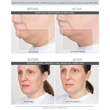 GLAM Face Cupping Therapy Set – Includes Anti-Aging Oil, Silicone Cleansing Brush