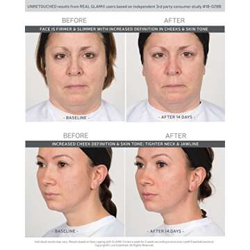 GLAM Face Cupping Therapy Set – Includes Anti-Aging Oil, Silicone Cleansing Brush