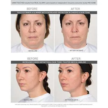 GLAM Face Cupping Therapy Set – Includes Anti-Aging Oil, Silicone Cleansing Brush