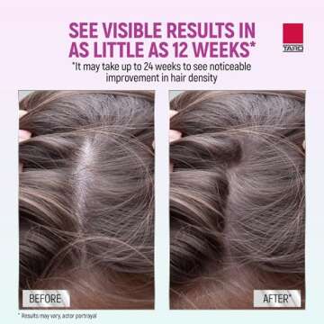 Taro Minoxidil Foam - Proven Hair Regrowth Treatment for Women
