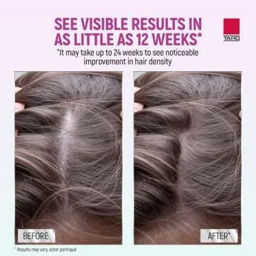 Taro Minoxidil Foam - Proven Hair Regrowth Treatment for Women