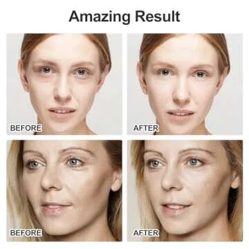 ZminRN Terahertz Gua Sha Facial Tools Guasha Tool for Face Body Gua Sha Stone Lymphatic Drainage Massager