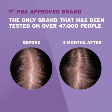 Women's Rogaine Hair Regrowth Treatment (One Month Supply) - Revitalize Your Quarantine Locks!