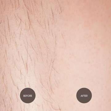 Nad's Wax Hair Removal For Women - Body+Face Wax - All Skin Types - At Home Waxing Kit With 6 Oz Sugar Wax, Cleansing Soap, Wooden Spatula, Re-Usable Cotton Strips