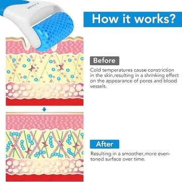 LATME Ice Roller for Face and Migraine Pain Relief