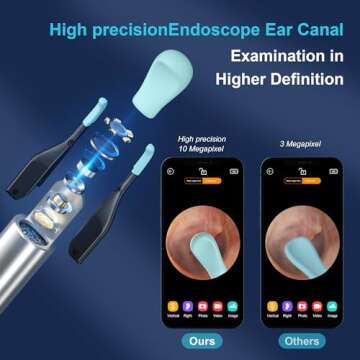 BEBIRD Ear Wax Removal Tool with 10MP Camera and Tweezers