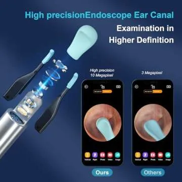 BEBIRD Ear Wax Removal Tool with 10MP Camera and Tweezers