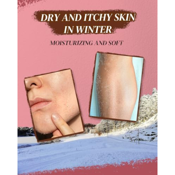 Larosanna Lanolin Cream for Itchy Dry Sensitive Skin