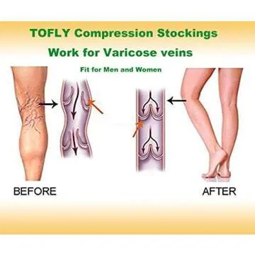 TOFLY Compression Stockings - Knee High Support Socks