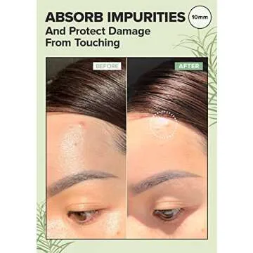 I DEW CARE Hydrocolloid Acne Pimple Patch - Timeout Blemish Original | Korean Zit Dark Spot Patches for Face and Skin, Pus absorbing with Tea Tree Oil, Facial Stickers, 36 Count