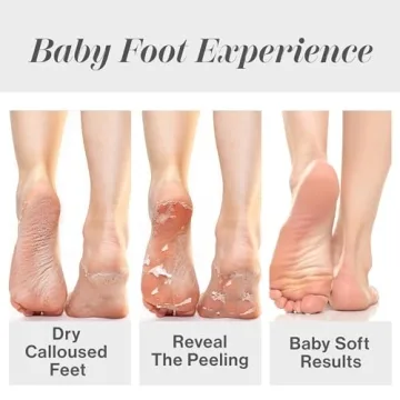 Baby Foot Peel for Soft, Smooth Feet - Spa Experience