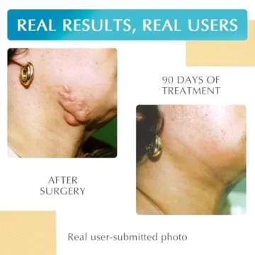 Advanced Silicone Scar Treatment Sheets for All Scars