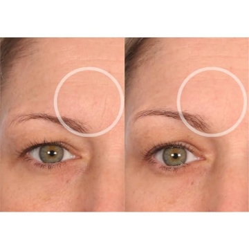 Reusable Anti-Wrinkle Patches for Neck Forehead Eye Smile