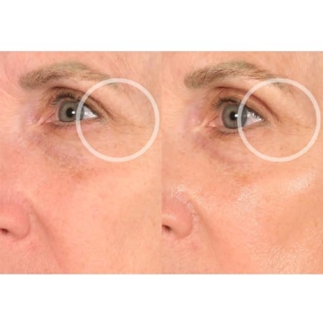 Reusable Anti-Wrinkle Patches for Neck Forehead Eye Smile