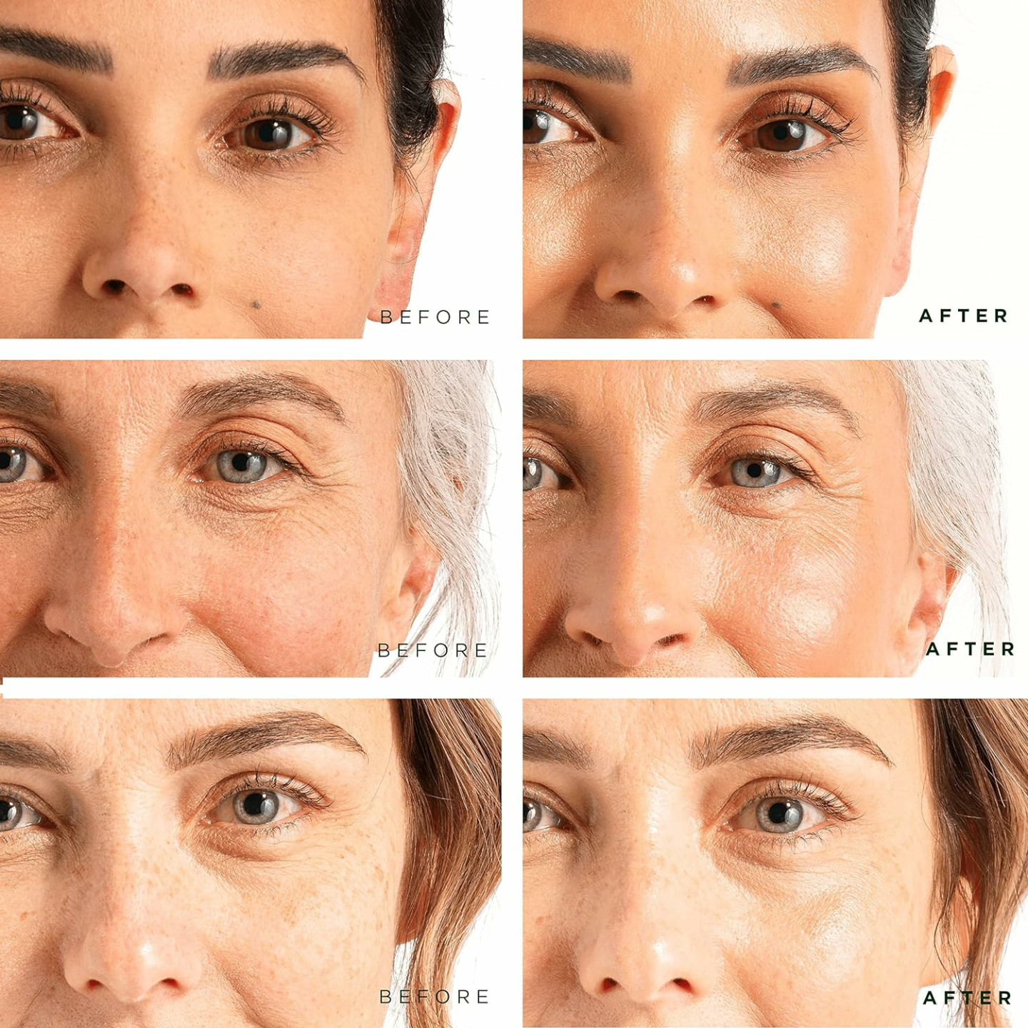 Anti Aging Serum Set with Vitamin C, Retinol & Hyaluronic Acid