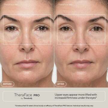 TheraFace PRO Microcurrent Facial Device for Anti-Aging