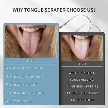 Liatinbo Stainless Steel Tongue Scraper for Fresh Breath