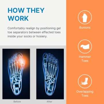 NatraCure Gel Toe Spacers for Bunions and Corns - 12 Pack