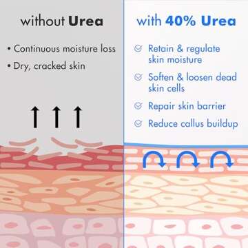 Ebanel Urea Cream 40% for Dry Cracked Skin - 2-Pack