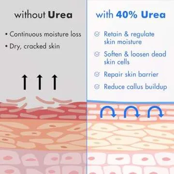 Ebanel Urea Cream 40% for Dry Cracked Skin - 2-Pack