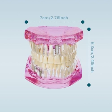 Windplusya Transparent Teeth Model for Educators and Patients