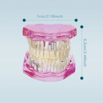 Windplusya Transparent Teeth Model for Educators and Patients