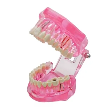 Windplusya Transparent Teeth Model for Educators and Patients