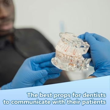 Windplusya Transparent Teeth Model for Educators and Patients