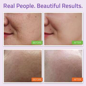 YEOUTH 6-Piece Skin Care Gift Set for All