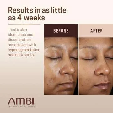 Ambi Even & Clear Advanced Fade Cream for All Skin Types