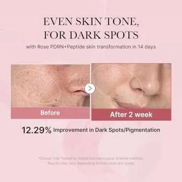 Medicube PDRN Pink Peptide Toner I Pink Glow Toner for Skin Boosting, Soothing and Calming, Uneven S...