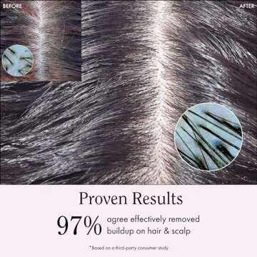 Rizos Curls Apple Cider Vinegar Scalp & Hair Rinse, Clarifies and Detox to Remove Product Buildup, Balance Oils, Revive Hair & Scalp, Enhances Softness & Shine, For All Hair Types 1a - 4c, 10 oz